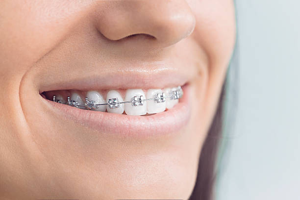 Best Dental X-Rays and Imaging  in Westke, LA